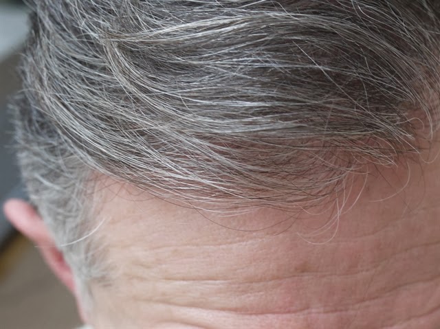 Tiết lộ bạn cách chữa bạc tóc 