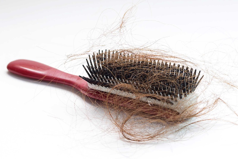 Tóc rụng quá nhiều là bệnh gì?