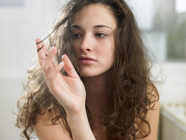Rụng tóc nhiều sau khi nhuộm