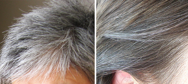 Kinh nghiệm chữa tóc bạc sớm
