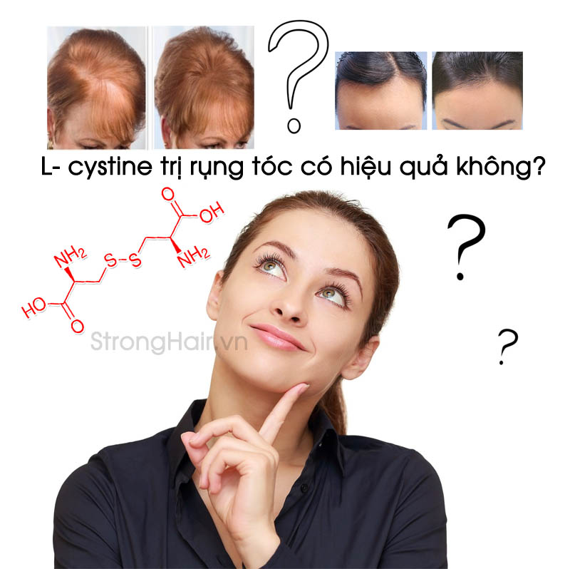 L-cystine trị rụng tóc