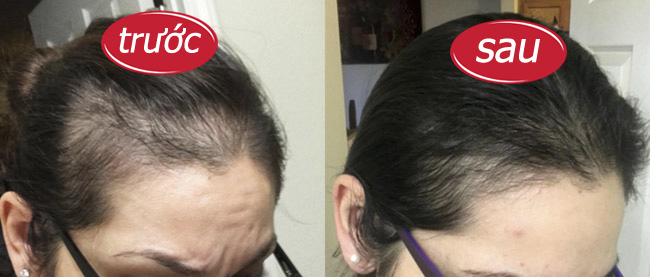 Trước và sau sử dụng Strong Hair