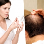 Nguyên nhân gây rụng tóc và các cách chữa trị hết rụng hiệu quả