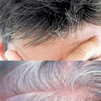 Nguyên nhân và cách trị hết bạc tóc chỉ với chanh và khế chua
